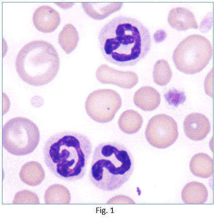 Ellie-Diagnostics-How-to-decide-if-inflammation-is-present-fig-1