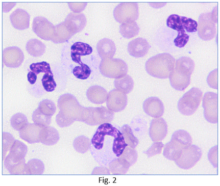 Ellie-Diagnostics-How-to-decide-if-inflammation-is-present-fig-2