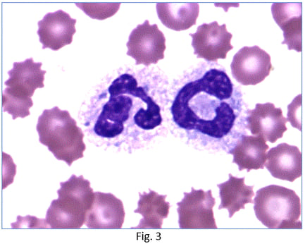 Ellie-Diagnostics-How-to-decide-if-inflammation-is-present-fig-3