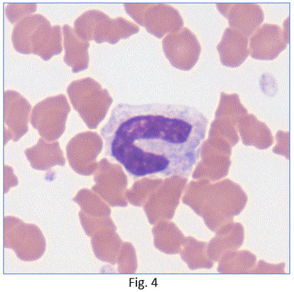 Ellie-Diagnostics-How-to-decide-if-inflammation-is-present-fig-4