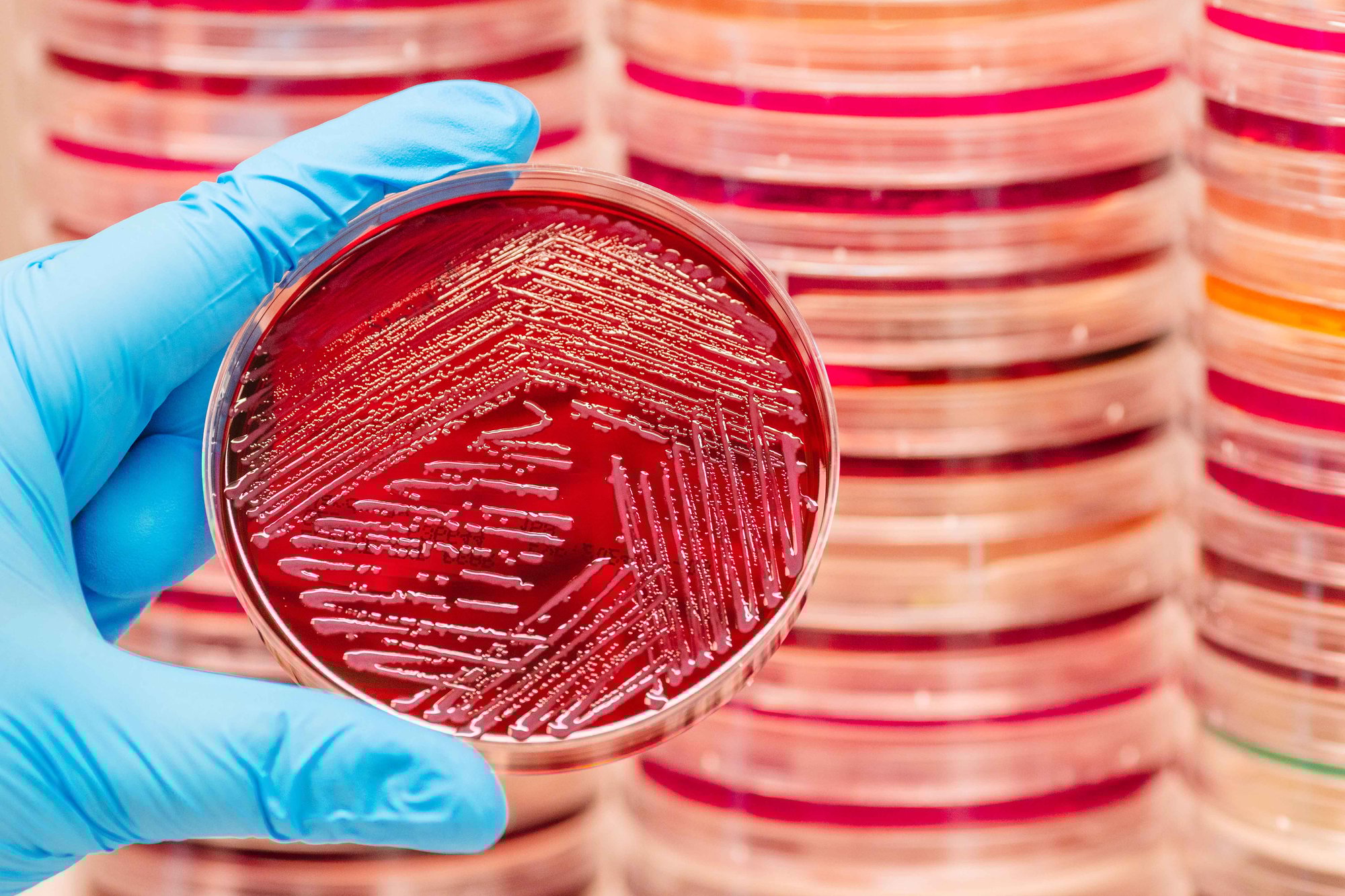 Microbiology-Cultures--05_resized Microbiology-Cultures--05_resized