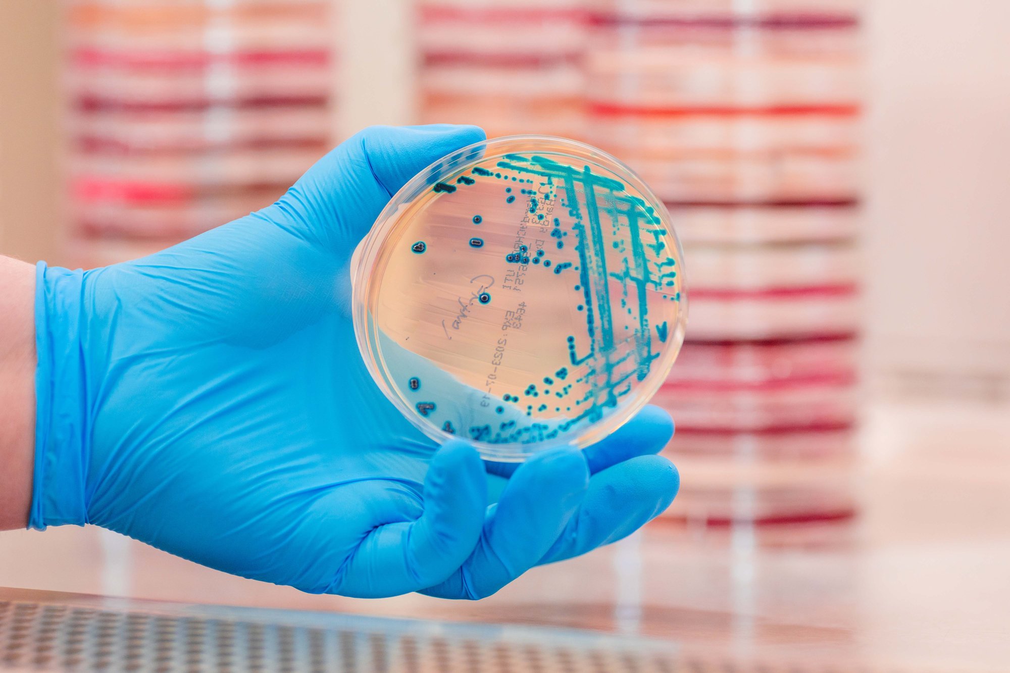 Microbiology-Cultures--16_resized